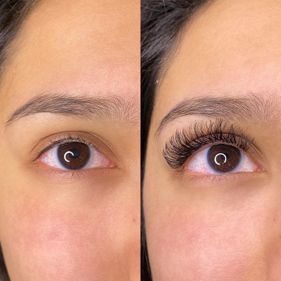 Antes/depois · cílios volume russo